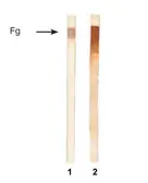 Anti-Fibrinogen antibody [1F3] used in Western Blot (WB). GTX10066
